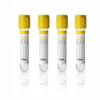 Vacuum Blood Collection Serum Separator Tube 3.5 mL, SST, Yellow Top 30207 Glass