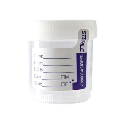Urine-Specimen-Container-without-Temperature-Strip-2.jpg